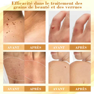 Spray venin d'abeille - élimine les imperfections