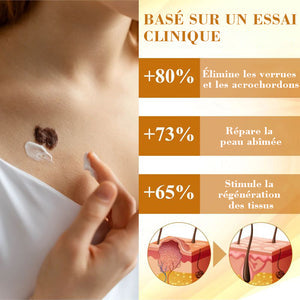 Spray venin d'abeille - élimine les imperfections