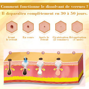 Spray venin d'abeille - élimine les imperfections
