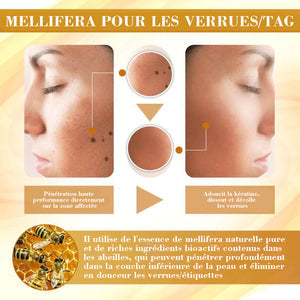 Spray venin d'abeille - élimine les imperfections