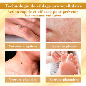 Spray venin d'abeille - élimine les imperfections