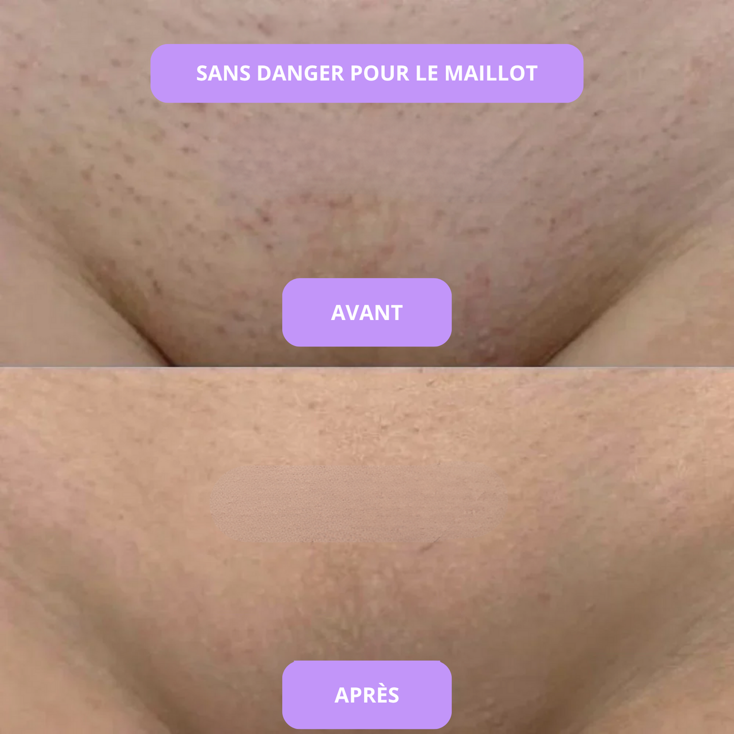 Sérum anti imperfections & contre la pousse des poils