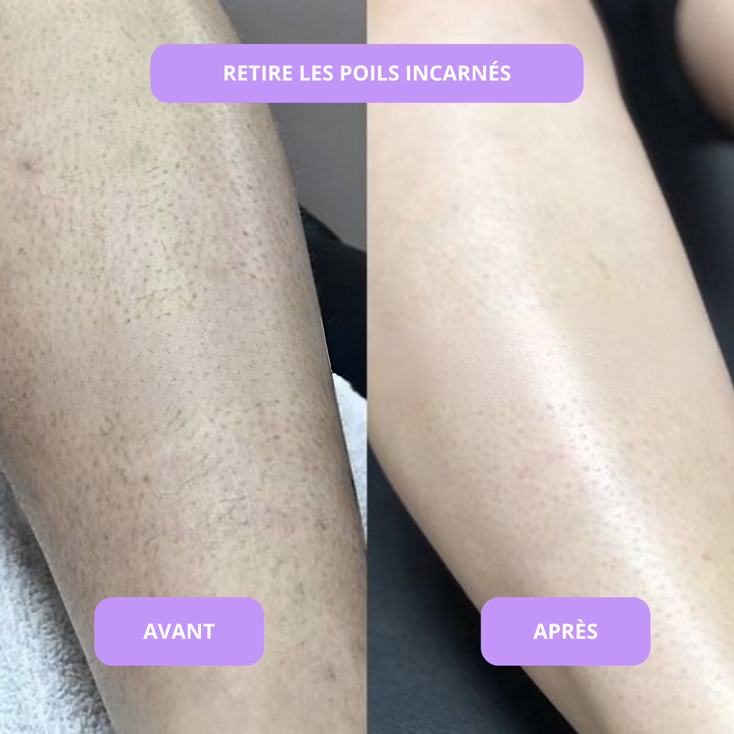 Sérum anti imperfections & contre la pousse des poils