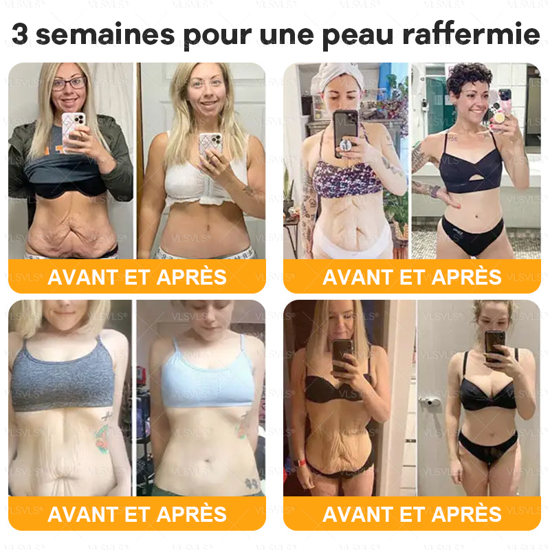 Shevin's Derma Crème Régénérante au Venin d’Abeille | Répare, lisse et revitalise votre peau en 10 minutes!
