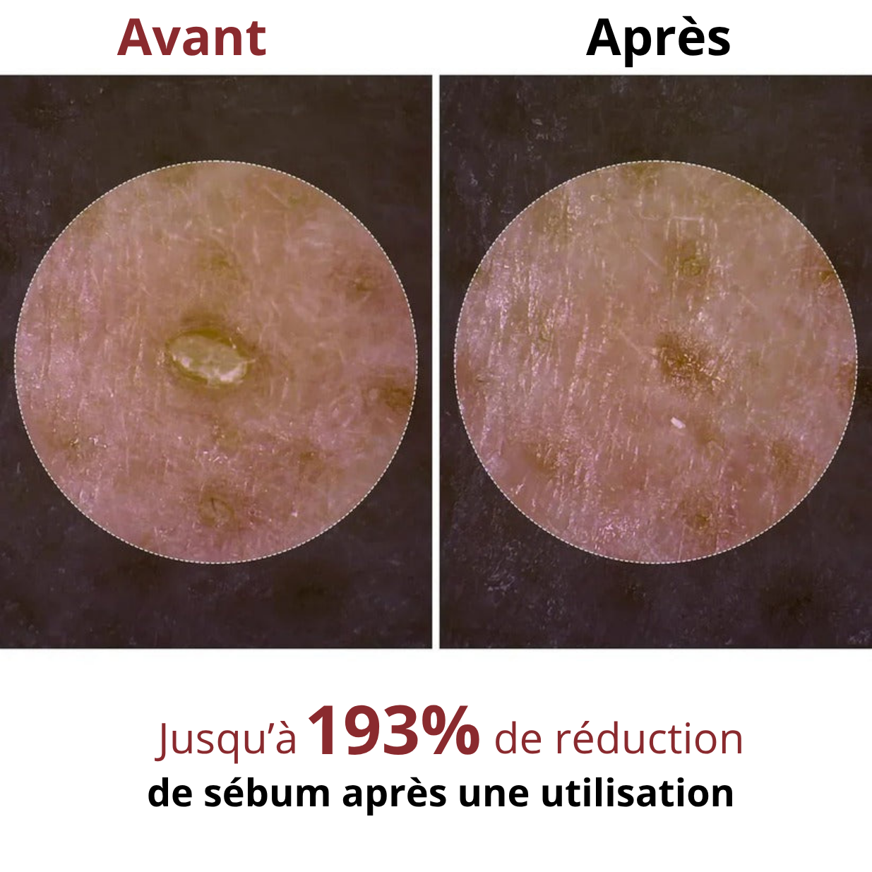 Sérum exfoliant Minoxil Shevin's