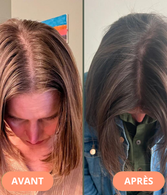 Après-Shampoing à l'eau de riz protéinée pour croissance des cheveux