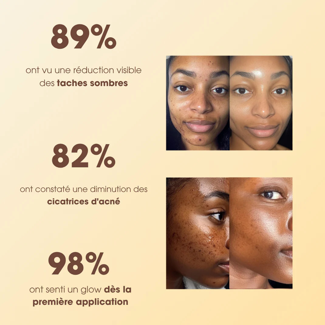 Savon Anti-Taches au Curcuma et à l’Acide Kojique (100g + 100g OFFERTS)