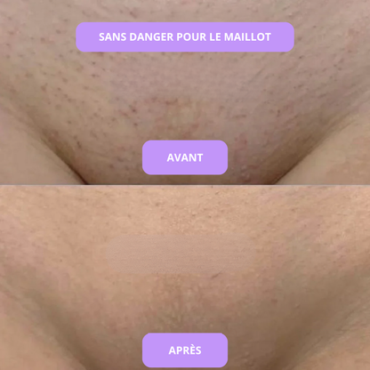 Sérum anti imperfections & contre la pousse des poils