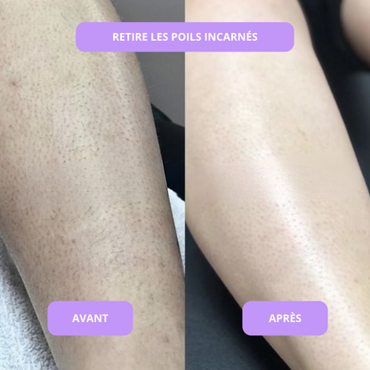 Sérum anti imperfections & contre la pousse des poils