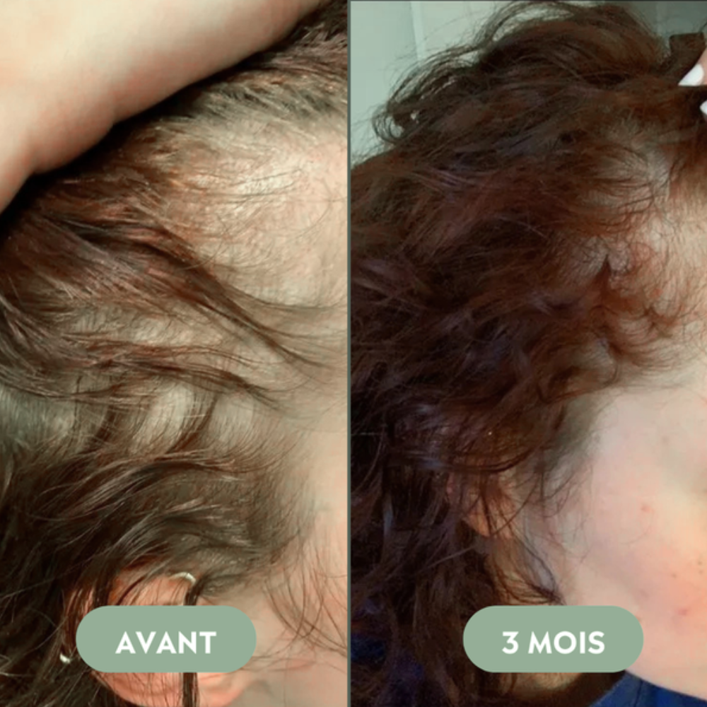 Shampooing à l'eau de riz protéinée pour croissance des cheveux