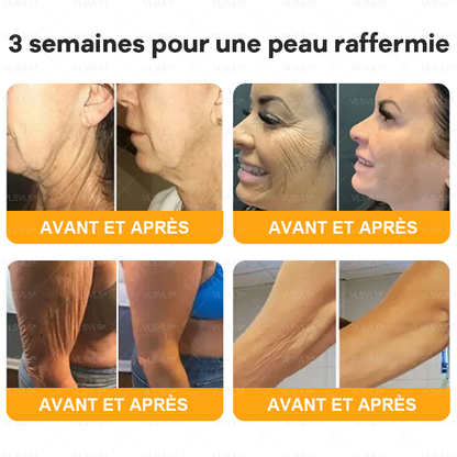 Shevin's Derma Crème Régénérante au Venin d’Abeille | Répare, lisse et revitalise votre peau en 10 minutes!