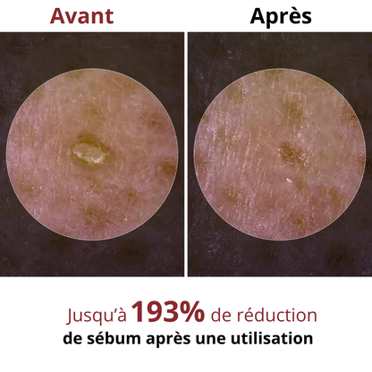 Sérum exfoliant Minoxil Shevin's